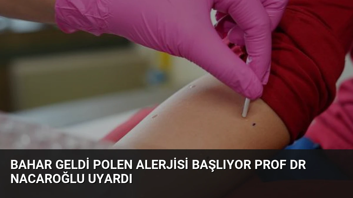 Bahar Geldi Polen Alerjisi Başlıyor Prof Dr Nacaroğlu Uyardı