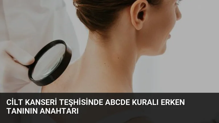 Cilt Kanseri Teşhisinde ABCDE Kuralı Erken Tanının Anahtarı